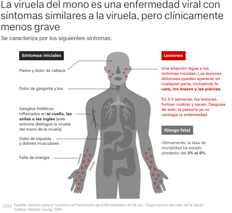 Viruela del mono/CNN