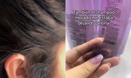 Tras oficio del Sernac por línea capilar que tendría fallas: L'Oreal descarta "potencial relación con caída del cabello"