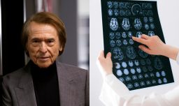 Enfermedad diagnosticada a Raphael: ¿Qué es un linfoma cerebral primario y cómo identificarlo?