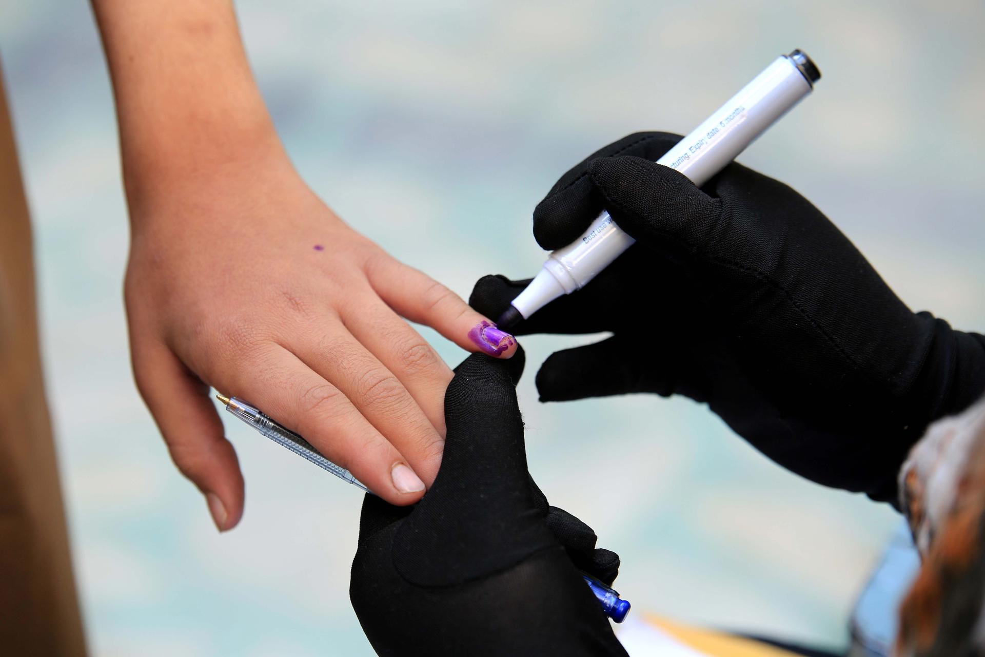 Fotografía de archivo de un niño que recibe la vacuna contra el Sarampión. EFE/EPA/BILAWAL ARBAB