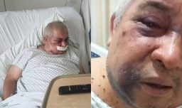 Denuncian brutal golpiza a conserje de 70 años por parte de empresario en Vitacura: Podría perder un ojo
