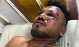 “Cuando me levanté, había cadáveres a mi alrededor”: El desgarrador relato del único sobreviviente de la tragedia aérea en India