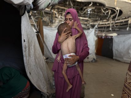 El desamparo de una madre palestina viuda con un hijo desnutrido: “Ya no se sostiene en pie”