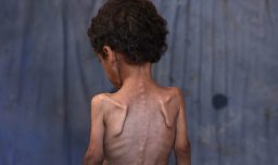 “Los débiles atienden a los débiles”: Médicos en Gaza se desmayan intentando salvar a sus pacientes hambrientos