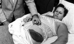 El día que un meteorito de 4.500 millones de años golpeó a Ann Hodges: La historia única que desafía las probabilidades