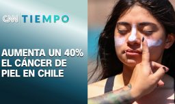En 10 años el cáncer de piel en Chile aumentó un 40% y se debe en su mayoría a la radiación UV