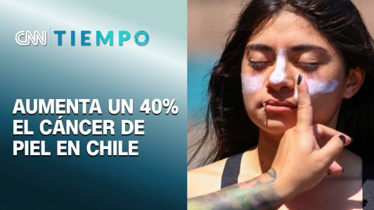En 10 años el cáncer de piel en Chile aumentó un 40% y se debe en su mayoría a la radiación UV