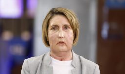 Realizan el primer trasplante de cara del mundo con una donante que recibió eutanasia