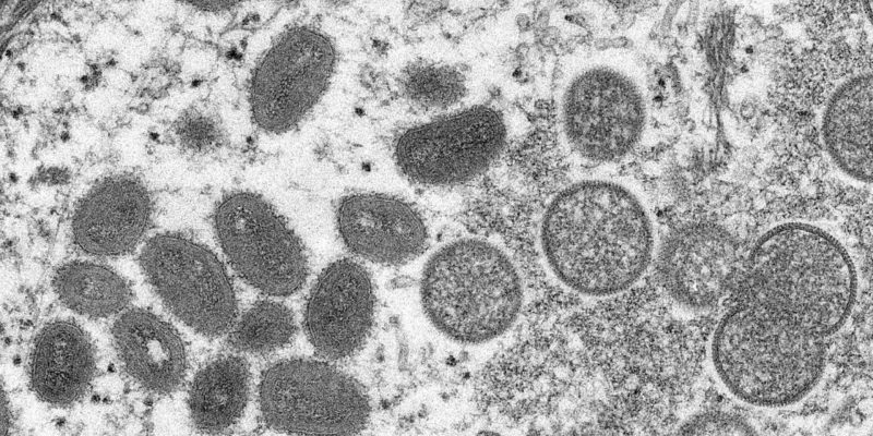 Los CDC dicen que la transmisión aérea de la viruela del mono “no ha sido reportada”